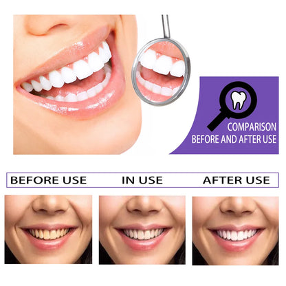 Remove yellow tooth stains, unpleasant odor, fresh mouth, fresh breath, purple toothpaste
